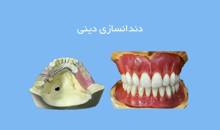 دندانسازی فردیس